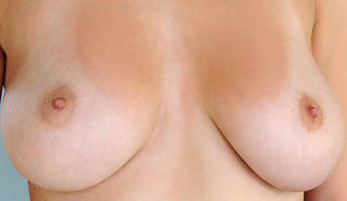 Close-up mamelons photos.
